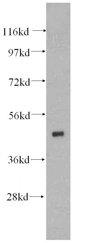 mouse brain tissue were subjected to SDS PAGE followed by western blot with Catalog No:111507(HNRNPH1 antibody) at dilution of 1:500
