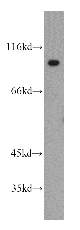 HeLa cells were subjected to SDS PAGE followed by western blot with Catalog No:116563(UHRF1 antibody) at dilution of 1:300
