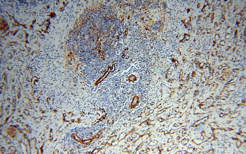 Immunohistochemical of paraffin-embedded human spleen using Catalog No:109054(CD146, MCAM antibody) at dilution of 1:100 (under 10x lens)