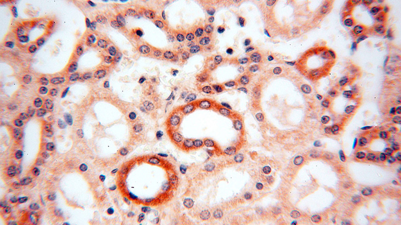 Immunohistochemical of paraffin-embedded human kidney using Catalog No:113060(NDUFA4L2 antibody) at dilution of 1:100 (under 40x lens)
