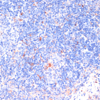 Immunohistochemistry - ZNRF3 Polyclonal Antibody 
