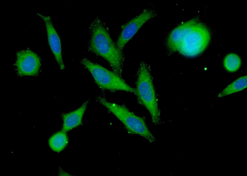 Immunofluorescent analysis of (-20oc Ethanol) fixed A549 cells using Catalog No:112697(MMP12 Antibody) at dilution of 1:25 and Alexa Fluor 488-congugated AffiniPure Goat Anti-Rabbit IgG(H+L)