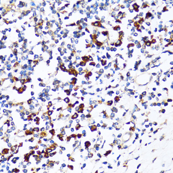 Immunohistochemistry - RPN1 Polyclonal Antibody 