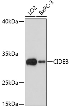 Western blot - CIDEB Polyclonal Antibody 