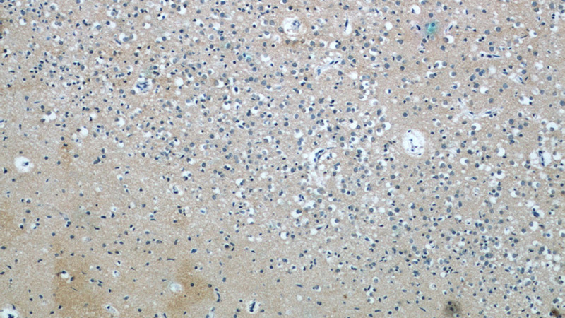Immunohistochemistry of paraffin-embedded human brain tissue slide using Catalog No:114658(RHOB Antibody) at dilution of 1:50 (under 10x lens)