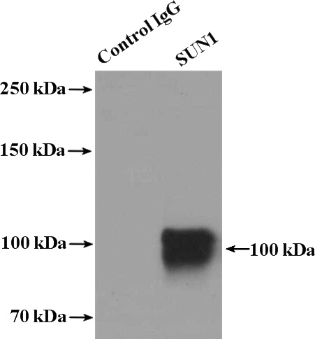 IP Result of anti-UNC84A (IP:Catalog No:115839, 4ug; Detection:Catalog No:115839 1:1000) with Jurkat cells lysate 3200ug.