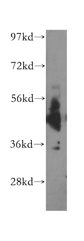 mouse testis tissue were subjected to SDS PAGE followed by western blot with Catalog No:108812(Cadm1 antibody) at dilution of 1:500