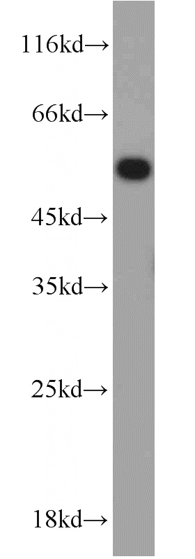 Jurkat cells were subjected to SDS PAGE followed by western blot with Catalog No:116664(UBR7 antibody) at dilution of 1:3000