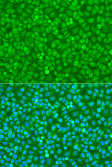 Immunofluorescence - FoxO3a Polyclonal Antibody 