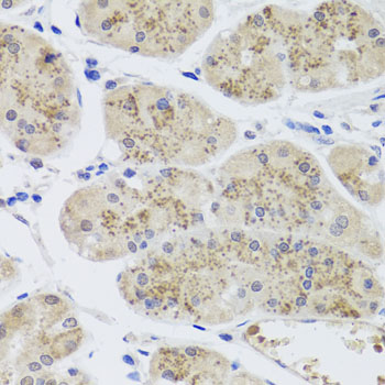 Immunohistochemistry - MTERFD3 Polyclonal Antibody 