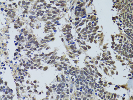 Immunohistochemistry - LKB1 Polyclonal Antibody 