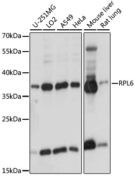 Western blot - RPL6 Polyclonal Antibody 