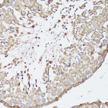 Immunohistochemistry - OPRK1 Polyclonal Antibody 
