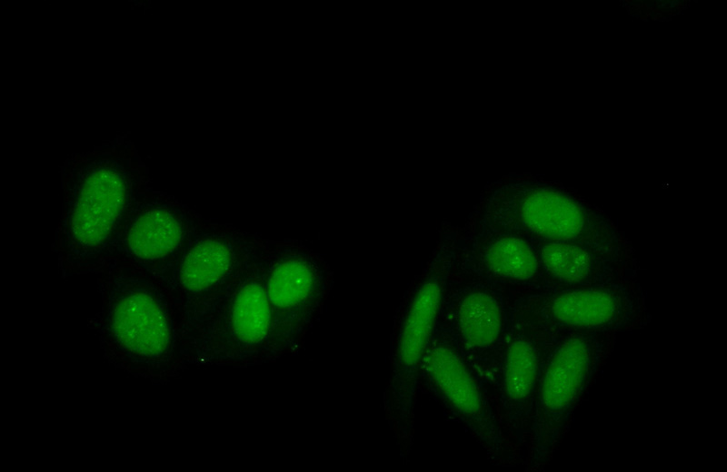 Immunofluorescent analysis of (10% Formaldehyde) fixed HepG2 cells using Catalog No:113578(PAPSS1 Antibody) at dilution of 1:50 and Alexa Fluor 488-congugated AffiniPure Goat Anti-Rabbit IgG(H+L)
