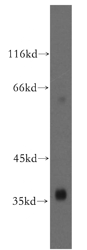 human kidney tissue were subjected to SDS PAGE followed by western blot with Catalog No:116685(USP46 antibody) at dilution of 1:500