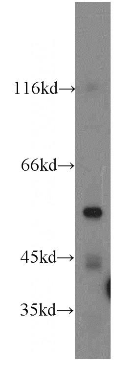 HeLa cells were subjected to SDS PAGE followed by western blot with Catalog No:108203(ARSK-Specific antibody) at dilution of 1:300