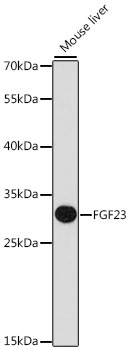 Western blot - FGF23 Polyclonal Antibody 