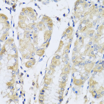 Immunohistochemistry - FANCA Polyclonal Antibody 