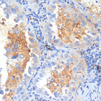 Immunohistochemistry - SEMA4C Polyclonal Antibody 