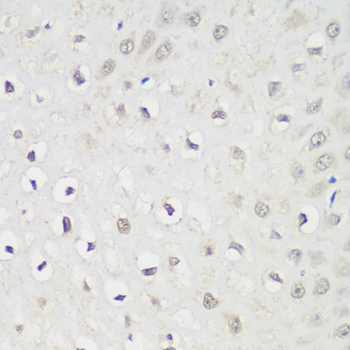 Immunohistochemistry - KPNA3 Polyclonal Antibody 