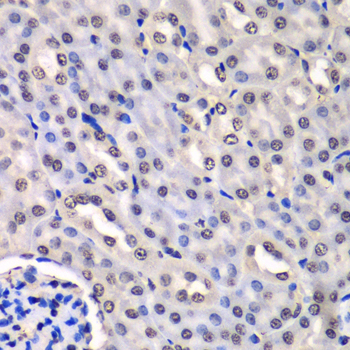 Immunohistochemistry - HNRNPM Polyclonal Antibody 