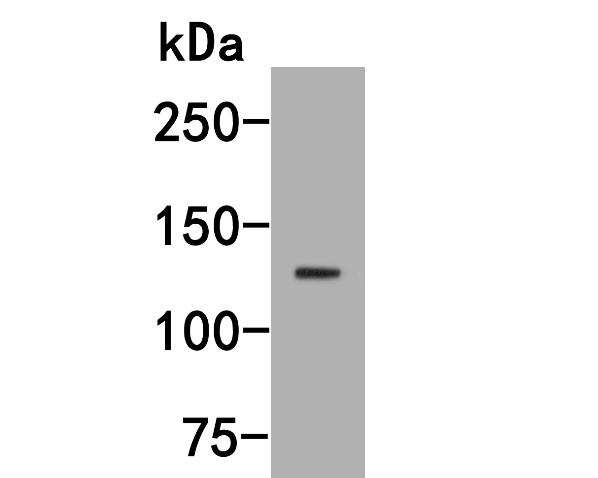 Fig1:; Western blot analysis of MyT1L on SHSY5Y cell lysates. Proteins were transferred to a PVDF membrane and blocked with 5% NFDM/TBST for 1 hour at room temperature. The primary antibody ( 1/1,000) was used in 5% NFDM/TBST at room temperature for 2 hours. Goat Anti-Rabbit IgG - HRP Secondary Antibody (HA1001) at 1:200,000 dilution was used for 1 hour at room temperature.
