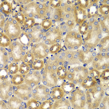 Immunohistochemistry - SMAD9 Polyclonal Antibody 