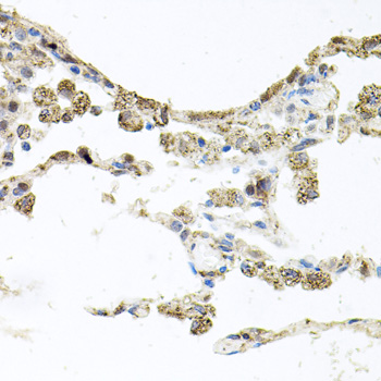 Immunohistochemistry - PI3 Kinase p110 beta Polyclonal Antibody 