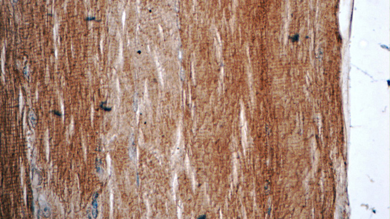 Immunohistochemistry of paraffin-embedded human skeletal muscle tissue slide using Catalog No:111919(KBTBD10 Antibody) at dilution of 1:50 (under 40x lens)