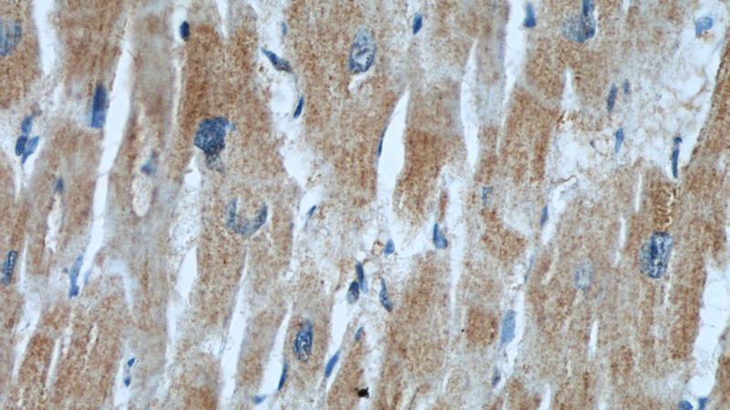 Immunohistochemistry of paraffin-embedded human heart slide using Catalog No:107175(CKM-Specific Antibody) at dilution of 1:50
