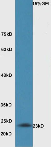 Fig2: Sample:Lung (Mouse) Lysate at 30 ug; Primary: Anti-Bak at 1:300 dilution;; Secondary: HRP conjugated Goat-Anti-Rabbit IgG(bse-0295G) at 1: 5000 dilution;; Predicted band size : 23kD; Observed band size : 23kD