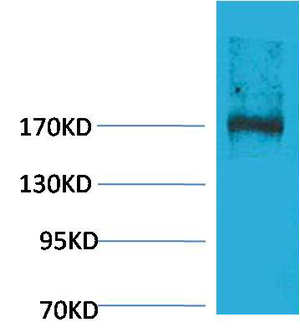 Fig1:; Western blot analysis of Rat Liver Tissue using EPG5 Polyclonal Antibody.. Secondary antibody（catalog#: HA1001) was diluted at 1:20000