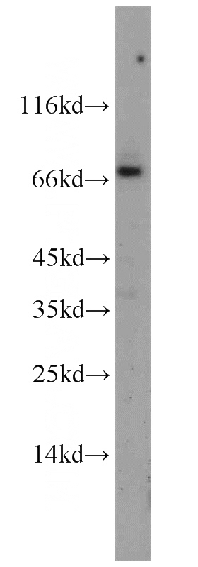 mouse brain tissue were subjected to SDS PAGE followed by western blot with Catalog No:109575(CRNN antibody) at dilution of 1:300