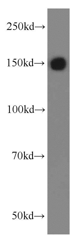 COLO 320 cells were subjected to SDS PAGE followed by western blot with Catalog No:116312(TRIM33 antibody) at dilution of 1:500