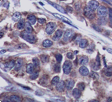 Immunohistochemistry - Phospho-DOK1-Y362 pAb 