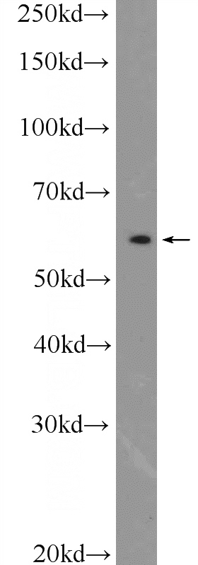 mouse brain tissue were subjected to SDS PAGE followed by western blot with Catalog No:114388(PSMC1 Antibody) at dilution of 1:1000