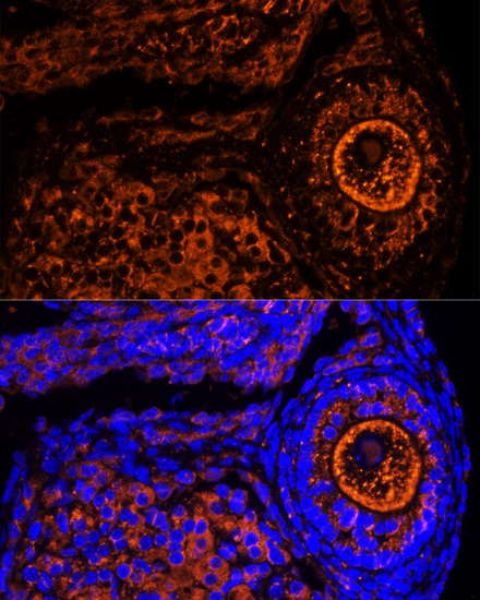 Immunofluorescence - ZP2 Polyclonal Antibody 