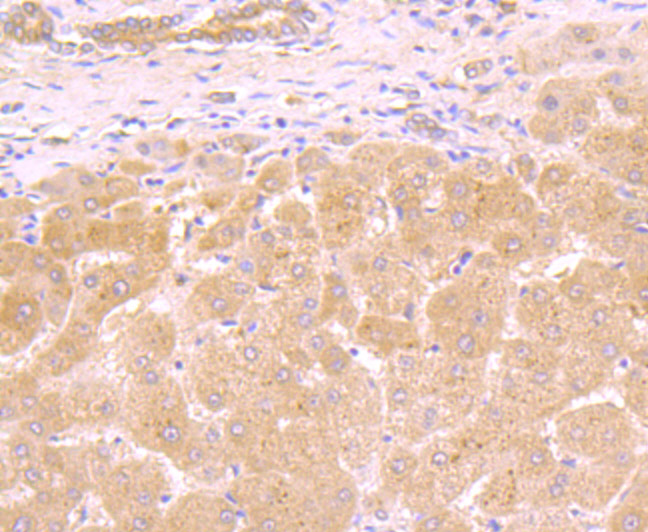 Fig5:; Immunohistochemical analysis of paraffin-embedded human liver tissue using anti-Galectin 8 antibody. The section was pre-treated using heat mediated antigen retrieval with Tris-EDTA buffer (pH 8.0-8.4) for 20 minutes.The tissues were blocked in 5% BSA for 30 minutes at room temperature, washed with ddH; 2; O and PBS, and then probed with the primary antibody ( 1/50) for 30 minutes at room temperature. The detection was performed using an HRP conjugated compact polymer system. DAB was used as the chromogen. Tissues were counterstained with hematoxylin and mounted with DPX.