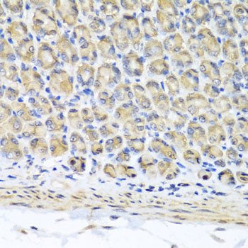Immunohistochemistry - STK3 Polyclonal Antibody 