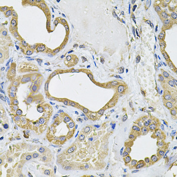 Immunohistochemistry - ICOSLG Polyclonal Antibody 