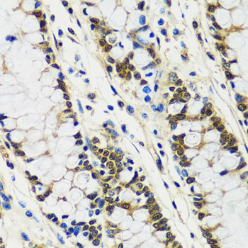 Immunohistochemistry - CCDC59 Polyclonal Antibody 