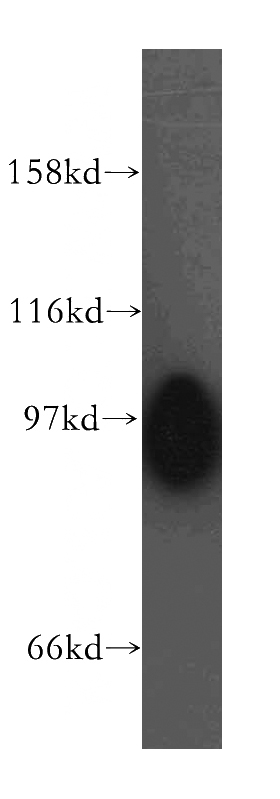 mouse skeletal muscle tissue were subjected to SDS PAGE followed by western blot with Catalog No:115127(ATP2A3 antibody) at dilution of 1:500