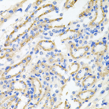 Immunohistochemistry - IRAK2 Polyclonal Antibody 