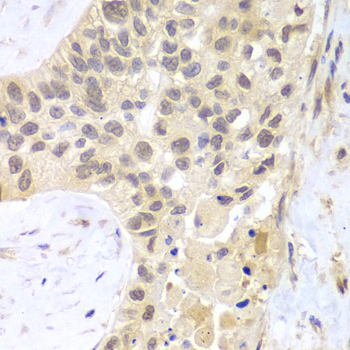 Immunohistochemistry - PSMC5 Polyclonal Antibody 