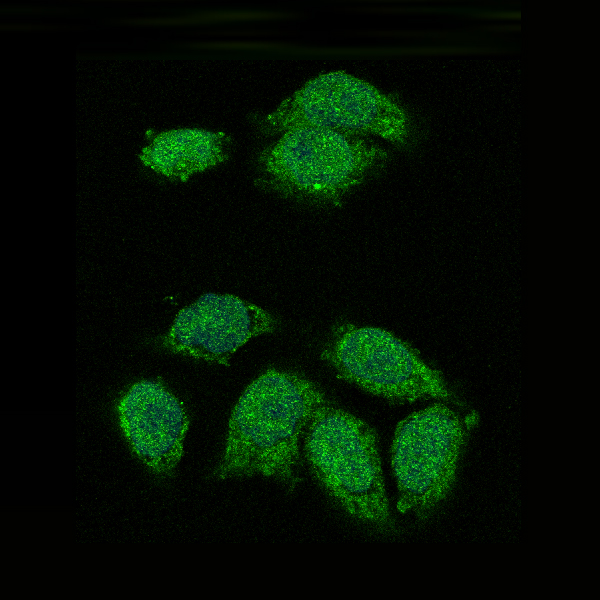 Immunofluorescent analysis of Hela cells, using IKB alpha Antibody .