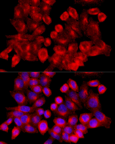 Immunofluorescence - CLTC Polyclonal Antibody 