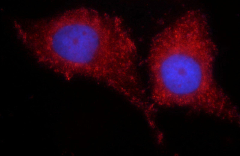 Immunofluorescent analysis of MCF-7 cells using Catalog No:116142(TIMP4 Antibody) at dilution of 1:25 and Rhodamine-Goat anti-Rabbit IgG