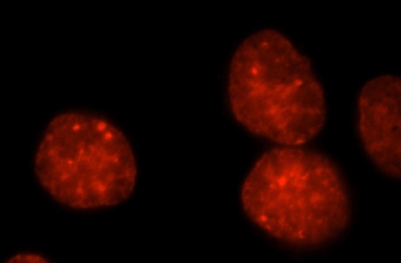 Immunofluorescent analysis of Hela cells, using TRIM28 antibody Catalog No:111911 at 1:25 dilution and Rhodamine-labeled goat anti-rabbit IgG (red).