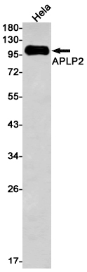 Western blot detection of APLP2 in Hela cell lysates using APLP2 Rabbit mAb(1:1000 diluted).Predicted band size:87kDa.Observed band size:87kDa.