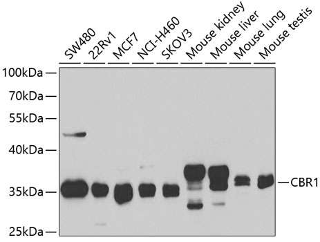 Western blot - CBR1 Polyclonal Antibody 